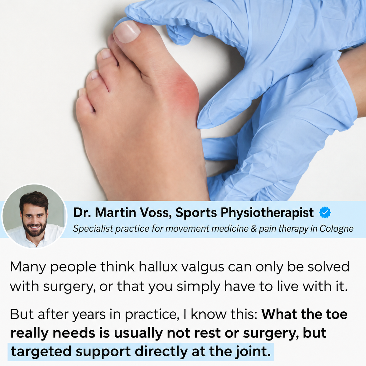 Hallux Valgus (Bunion) - TAPEFORM